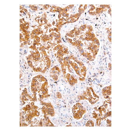 Immunohistochemistry - Anti-ROS1 Antibody [IHC094] (A324513) - Antibodies.com