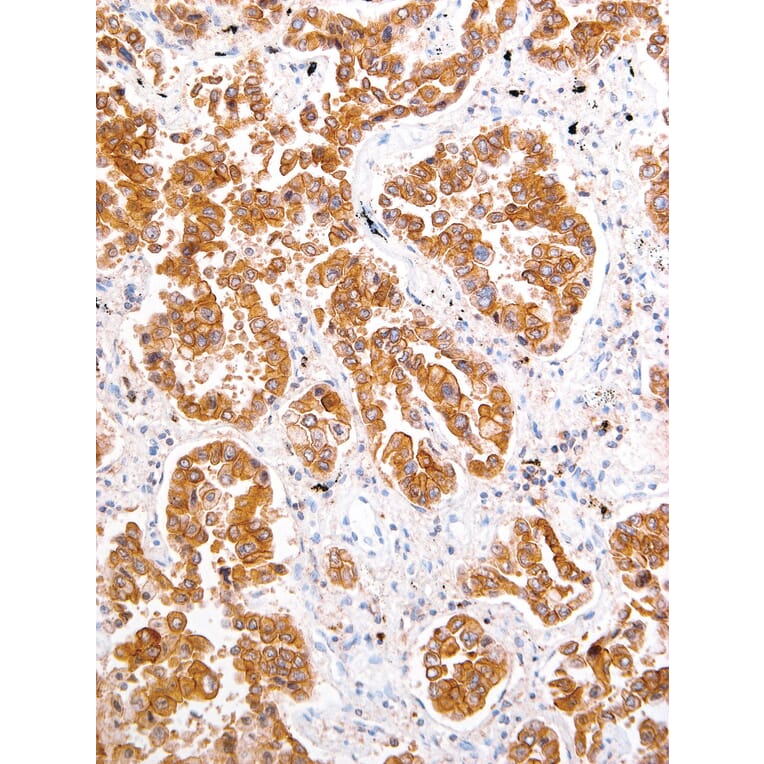 Immunohistochemistry - Anti-ROS1 Antibody [IHC094] (A324513) - Antibodies.com