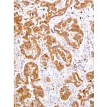 Immunohistochemistry - Anti-ROS1 Antibody [IHC094] (A324513) - Antibodies.com