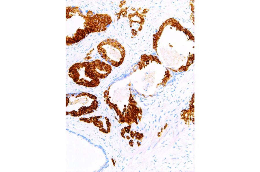 Immunohistochemistry - Anti-AMACR Antibody [IHC524] (A324514) - Antibodies.com