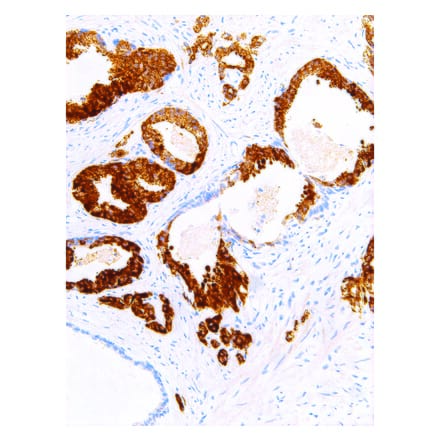 Immunohistochemistry - Anti-AMACR Antibody [IHC524] (A324514) - Antibodies.com