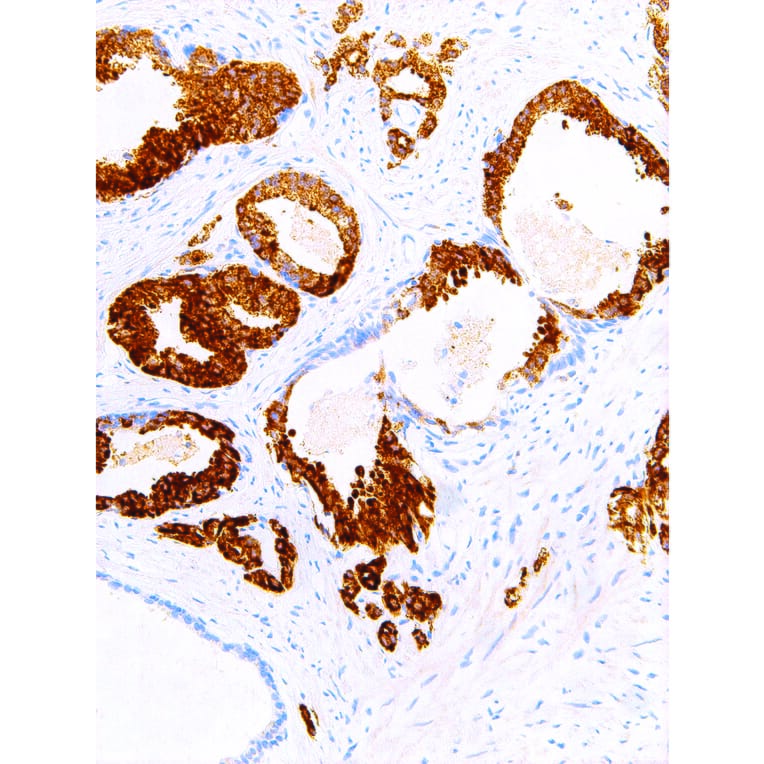 Immunohistochemistry - Anti-AMACR Antibody [IHC524] (A324514) - Antibodies.com