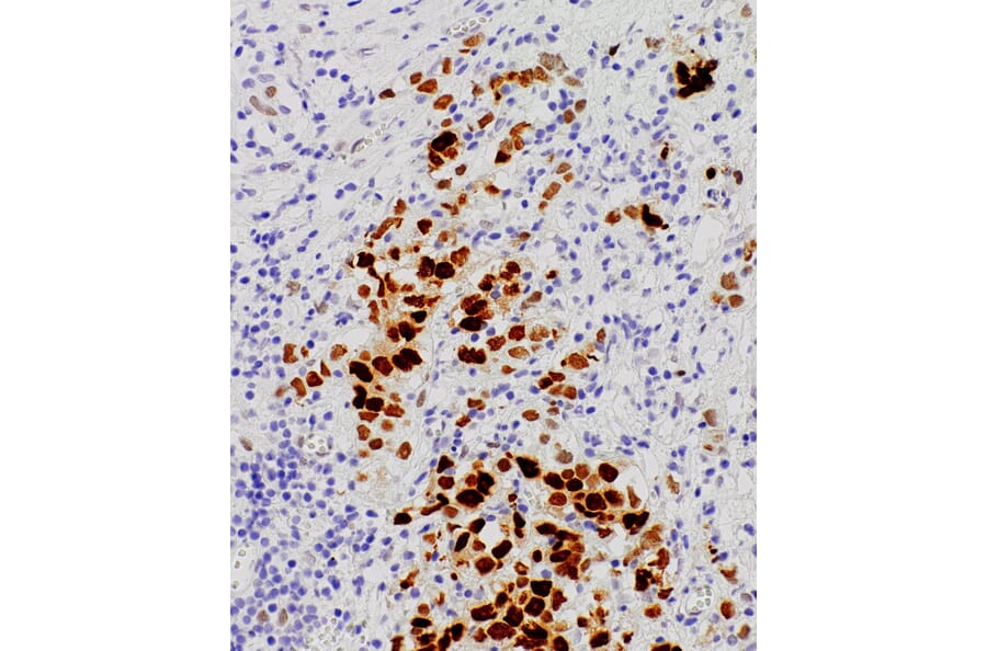Immunohistochemistry - Anti-Androgen Receptor Antibody [IHC511] (A324515) - Antibodies.com