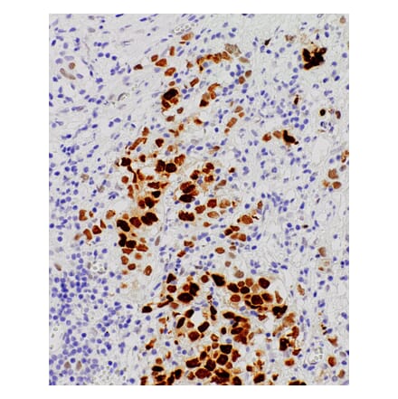 Immunohistochemistry - Anti-Androgen Receptor Antibody [IHC511] (A324515) - Antibodies.com