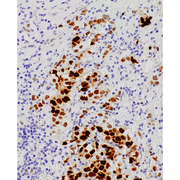 Immunohistochemistry - Anti-Androgen Receptor Antibody [IHC511] (A324515) - Antibodies.com