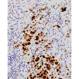 Immunohistochemistry - Anti-Androgen Receptor Antibody [IHC511] (A324515) - Antibodies.com