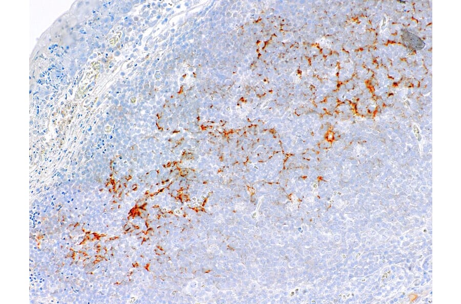 Immunohistochemistry - Anti-C4d Antibody [IHC519] (A324516) - Antibodies.com