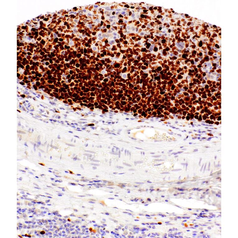 Immunohistochemistry - Anti-Ki67 Antibody [IHC167] (A324518) - Antibodies.com