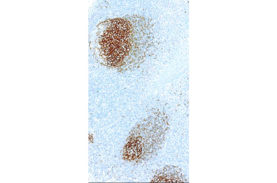 Immunohistochemistry - Anti-CD23 Antibody [IHC023] (A324519) - Antibodies.com