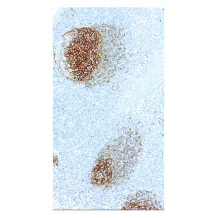 Immunohistochemistry - Anti-CD23 Antibody [IHC023] (A324519) - Antibodies.com