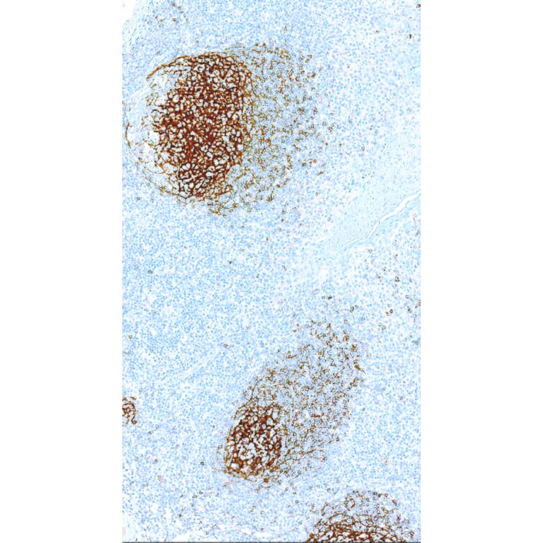 Immunohistochemistry - Anti-CD23 Antibody [IHC023] (A324519) - Antibodies.com