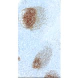 Immunohistochemistry - Anti-CD23 Antibody [IHC023] (A324519) - Antibodies.com