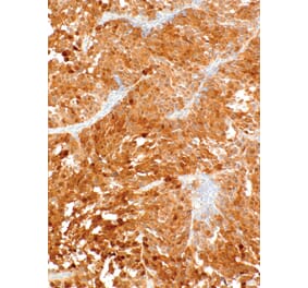 Immunohistochemistry - Anti-Cdk4 Antibody [IHC077] (A324523) - Antibodies.com