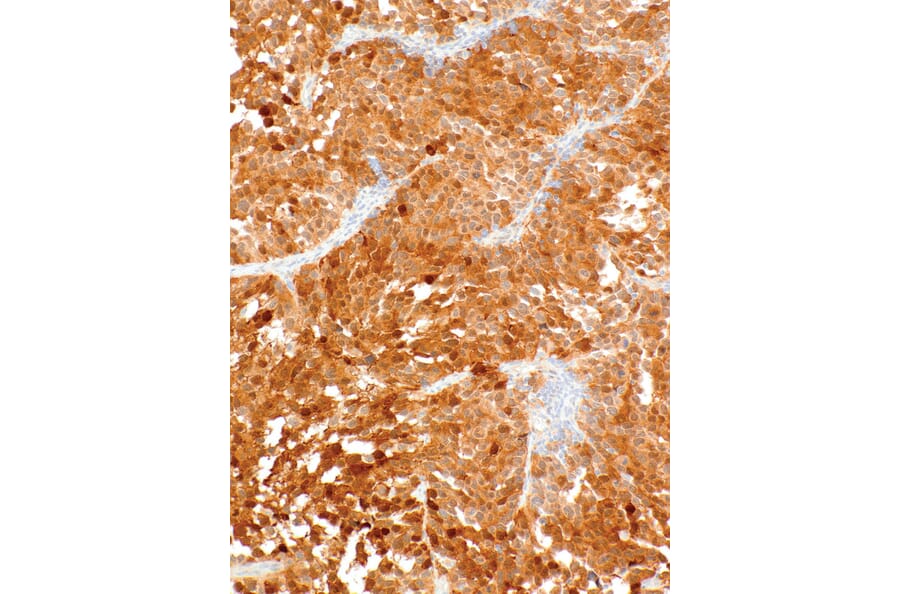 Immunohistochemistry - Anti-Cdk4 Antibody [IHC077] (A324523) - Antibodies.com