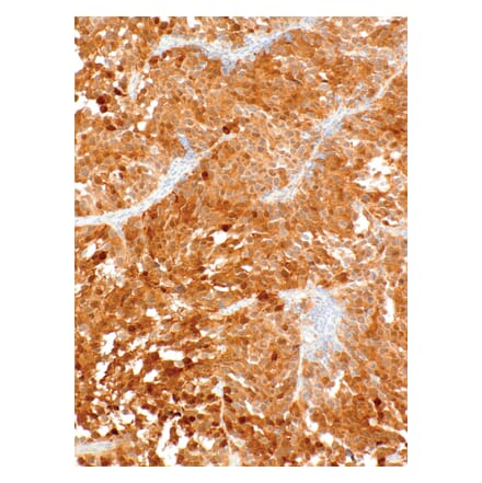 Immunohistochemistry - Anti-Cdk4 Antibody [IHC077] (A324523) - Antibodies.com