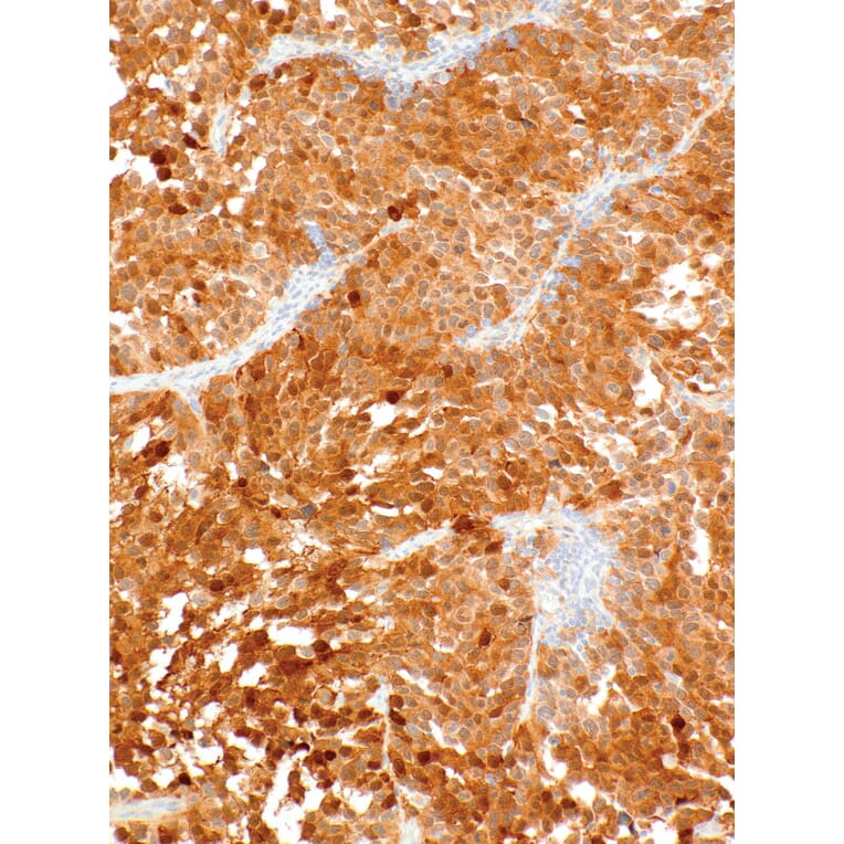 Immunohistochemistry - Anti-Cdk4 Antibody [IHC077] (A324523) - Antibodies.com