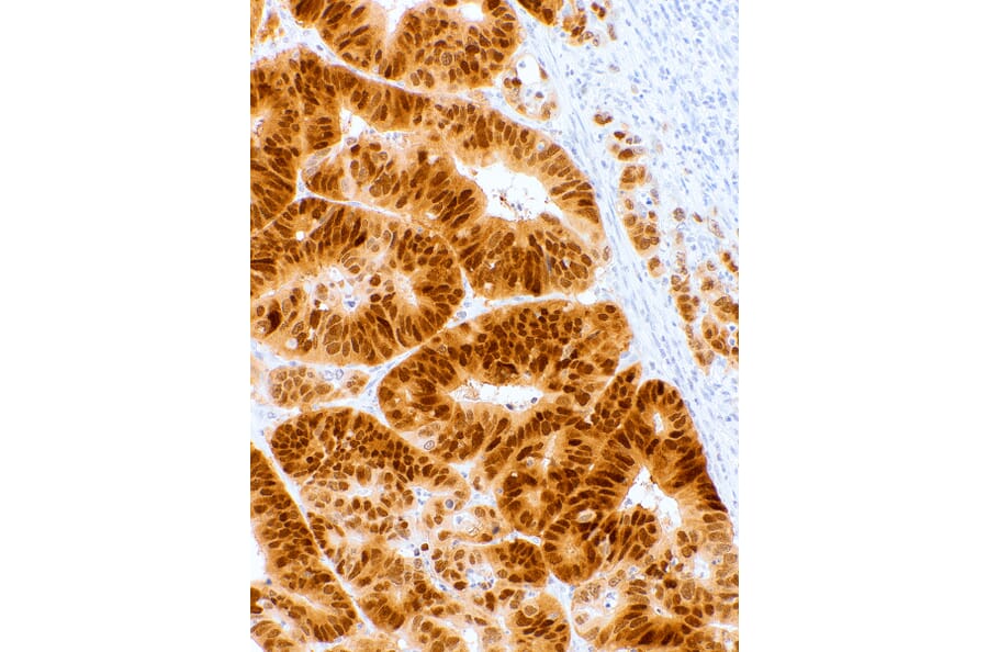 Immunohistochemistry - Anti-CDX2 Antibody [IHC302] (A324524) - Antibodies.com