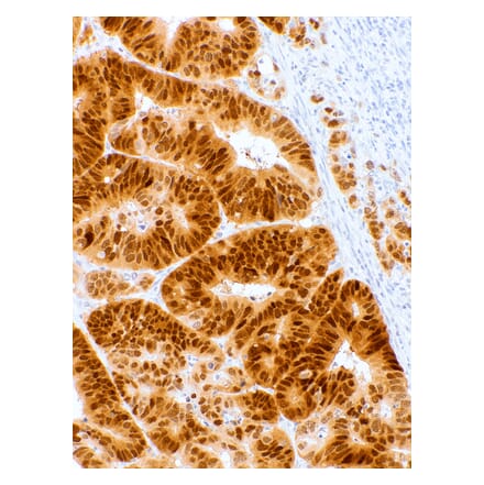 Immunohistochemistry - Anti-CDX2 Antibody [IHC302] (A324524) - Antibodies.com