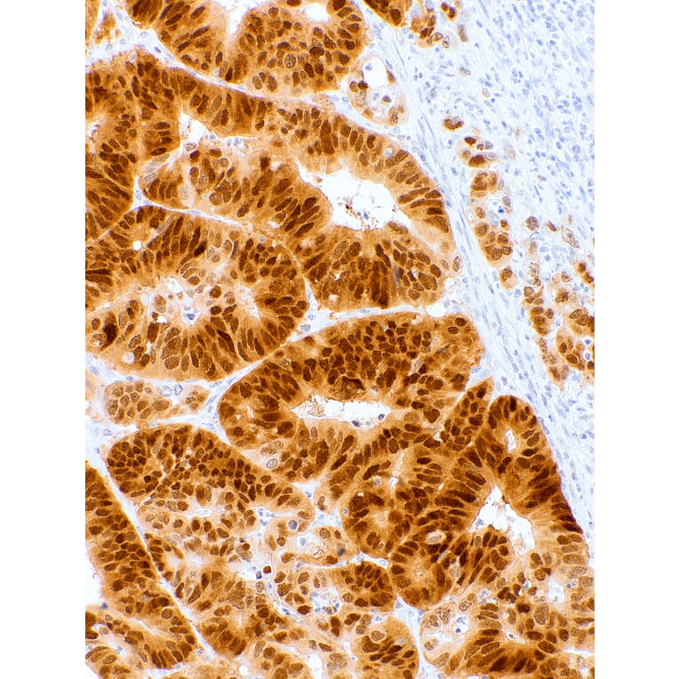Immunohistochemistry - Anti-CDX2 Antibody [IHC302] (A324524) - Antibodies.com