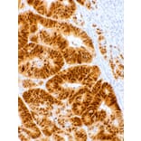 Immunohistochemistry - Anti-CDX2 Antibody [IHC302] (A324524) - Antibodies.com