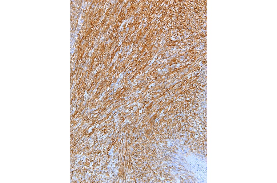 Immunohistochemistry - Anti-c-Kit Antibody [IHC526] (A324525) - Antibodies.com