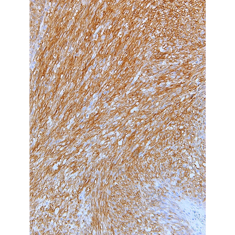 Immunohistochemistry - Anti-c-Kit Antibody [IHC526] (A324525) - Antibodies.com