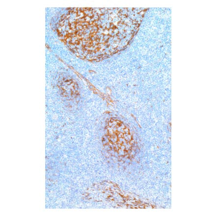Immunohistochemistry - Anti-Clusterin Antibody [IHC546] (A324526) - Antibodies.com