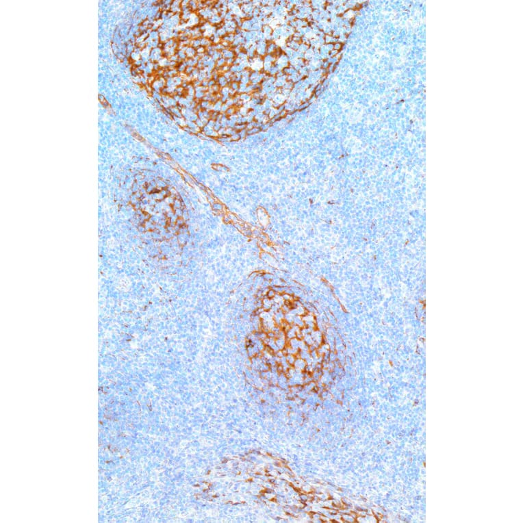 Immunohistochemistry - Anti-Clusterin Antibody [IHC546] (A324526) - Antibodies.com