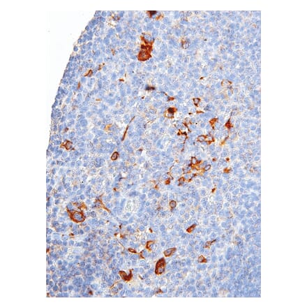 Immunohistochemistry - Anti-CTLA4 Antibody [IHC064] (A324529) - Antibodies.com