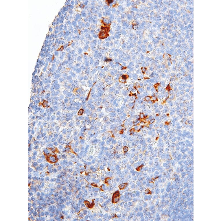 Immunohistochemistry - Anti-CTLA4 Antibody [IHC064] (A324529) - Antibodies.com