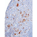 Immunohistochemistry - Anti-CTLA4 Antibody [IHC064] (A324529) - Antibodies.com