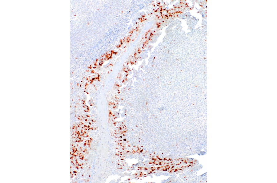 Immunohistochemistry - Anti-Cyclin D1 Antibody [IHC452] (A324531) - Antibodies.com