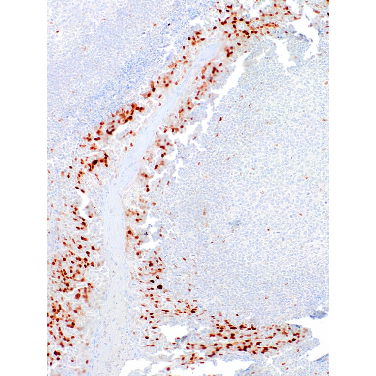 Immunohistochemistry - Anti-Cyclin D1 Antibody [IHC452] (A324531) - Antibodies.com