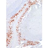 Immunohistochemistry - Anti-Cyclin D1 Antibody [IHC452] (A324531) - Antibodies.com