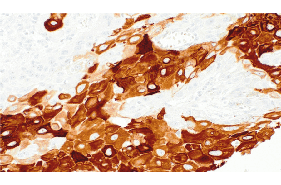 Immunohistochemistry - Anti-Cytokeratin 10 Antibody [IHC135] (A324532) - Antibodies.com