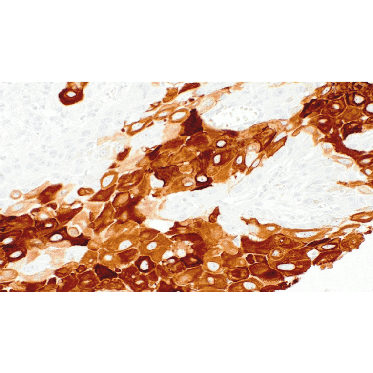 Immunohistochemistry - Anti-Cytokeratin 10 Antibody [IHC135] (A324532) - Antibodies.com