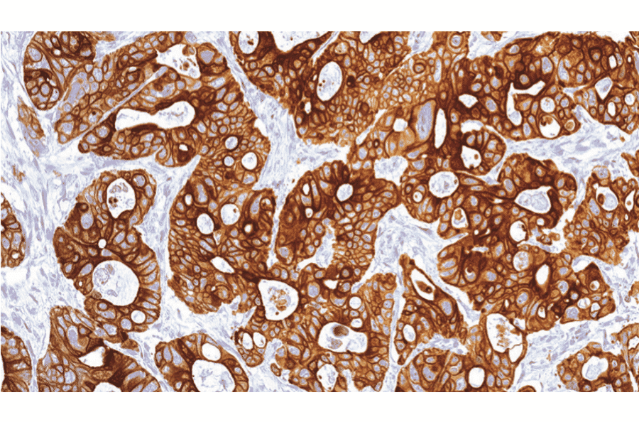 Immunohistochemistry - Anti-Cytokeratin 20 Antibody [IHC220] (A324533) - Antibodies.com