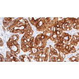 Immunohistochemistry - Anti-Cytokeratin 20 Antibody [IHC220] (A324533) - Antibodies.com