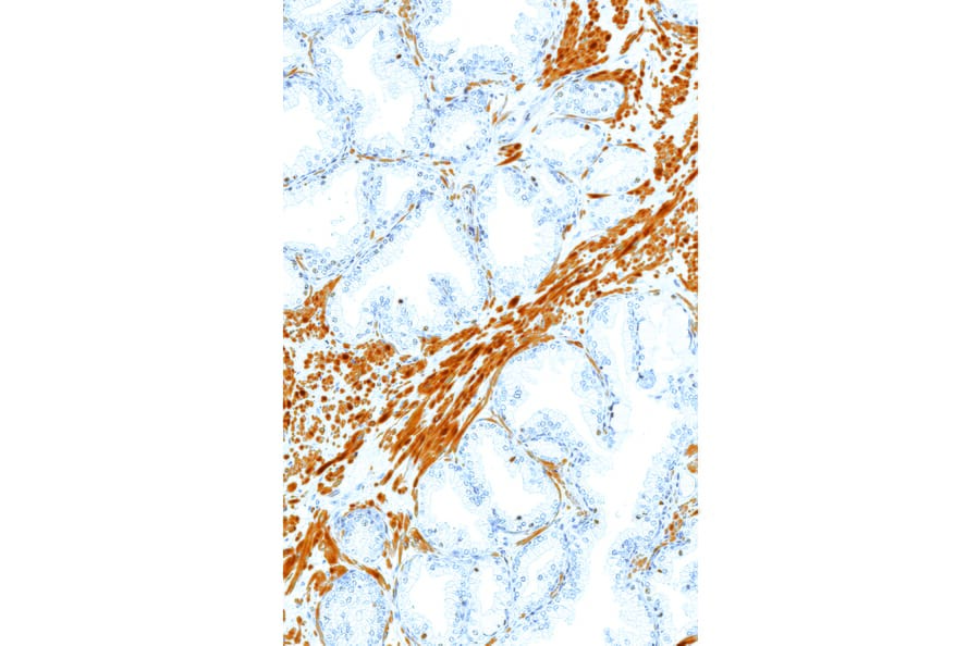 Immunohistochemistry - Anti-ERG Antibody [IHC569] (A324536) - Antibodies.com