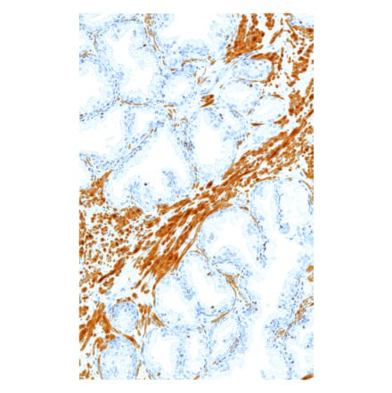 Immunohistochemistry - Anti-ERG Antibody [IHC569] (A324536) - Antibodies.com