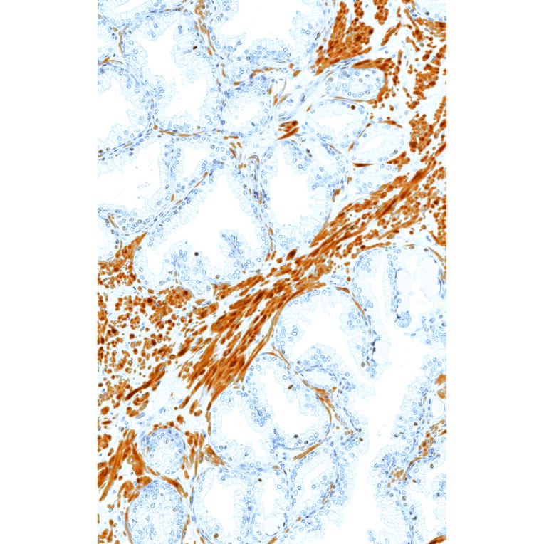 Immunohistochemistry - Anti-ERG Antibody [IHC569] (A324536) - Antibodies.com