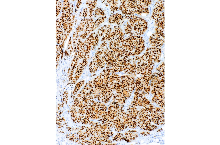 Immunohistochemistry - Anti-Estrogen Receptor alpha Antibody [IHC423] (A324537) - Antibodies.com