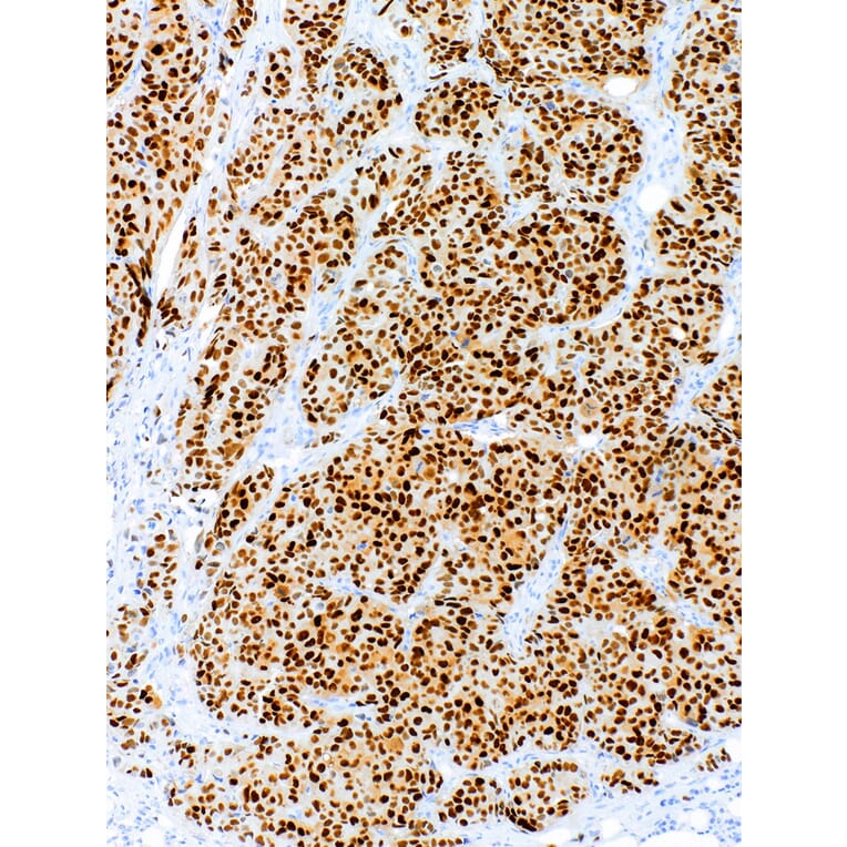 Immunohistochemistry - Anti-Estrogen Receptor alpha Antibody [IHC423] (A324537) - Antibodies.com