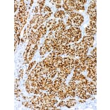 Immunohistochemistry - Anti-Estrogen Receptor alpha Antibody [IHC423] (A324537) - Antibodies.com