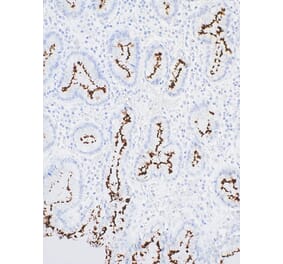 Immunohistochemistry - Anti-Helicobacter pylori Antibody [IHC416] (A324539) - Antibodies.com