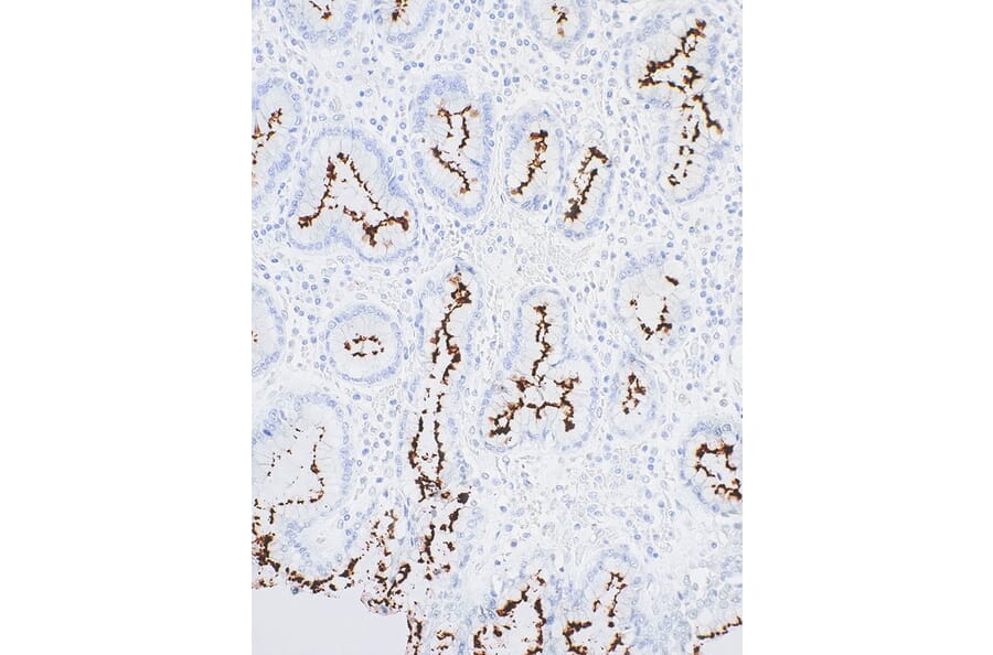 Immunohistochemistry - Anti-Helicobacter pylori Antibody [IHC416] (A324539) - Antibodies.com