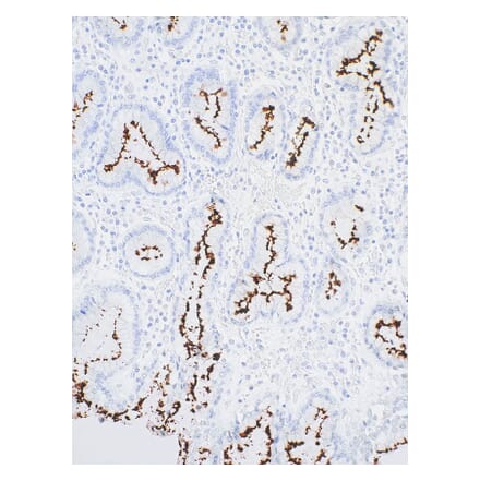 Immunohistochemistry - Anti-Helicobacter pylori Antibody [IHC416] (A324539) - Antibodies.com