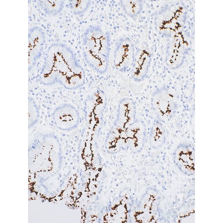 Immunohistochemistry - Anti-Helicobacter pylori Antibody [IHC416] (A324539) - Antibodies.com