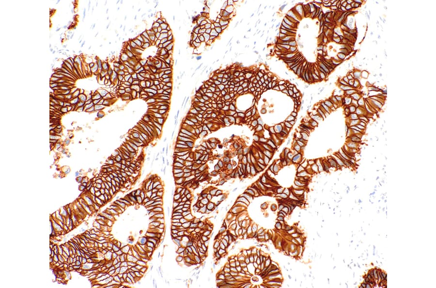 Immunohistochemistry - Anti-LI Cadherin Antibody [IHC520] (A324543) - Antibodies.com