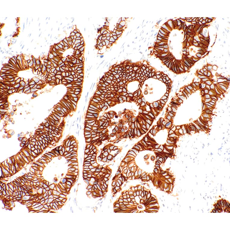 Immunohistochemistry - Anti-LI Cadherin Antibody [IHC520] (A324543) - Antibodies.com